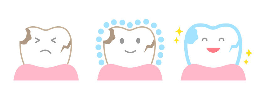 歯のイラスト