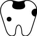 虫歯の治療のイラスト