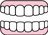 入れ歯を作る治療のイラスト